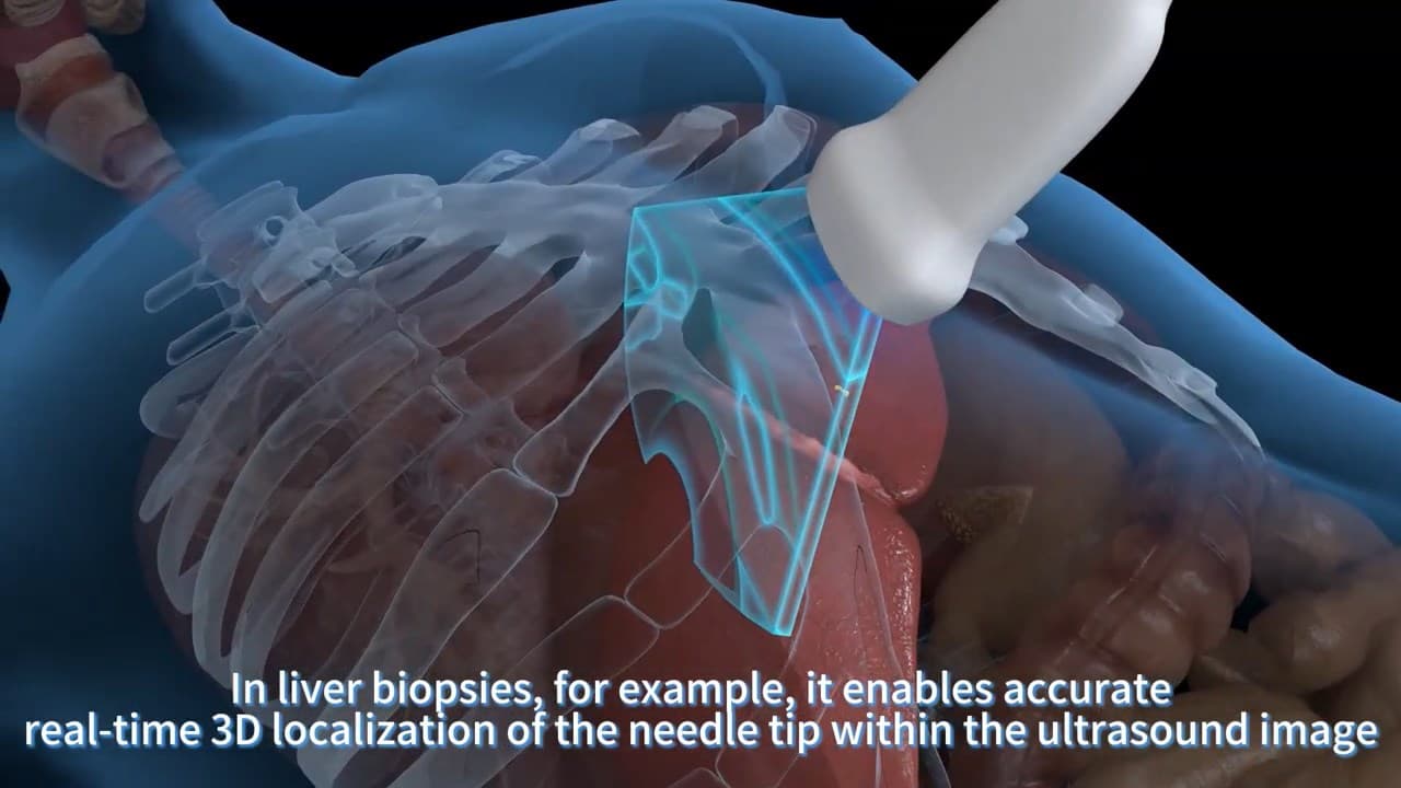 Real-Time Tracking UI